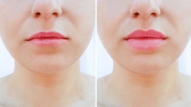Why Are Lip Filler A Popular Choice For Enhancing Lip Aesthetics