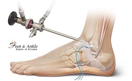 Where to Get Ligament Repair Surgery in Scottsdale