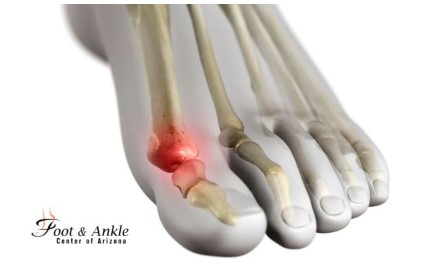 Who Should You Consult for Metatarsophalangeal Joint Pain