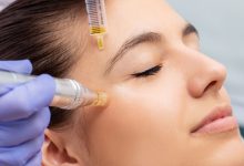 Finding the Pros of Radiant’s Face Lift and RF Microneedling Treatments in East Brunswick and Central New Jersey